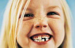 Quando si fa la prima visita dal dentista?