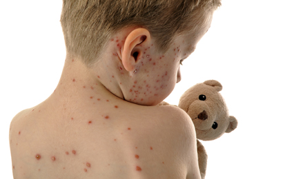 Una storia contagiosa…