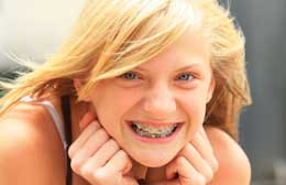 L’apparecchio senza stress? terapie in tempi giusti ed efficaci grazie al dialogo con le famiglie